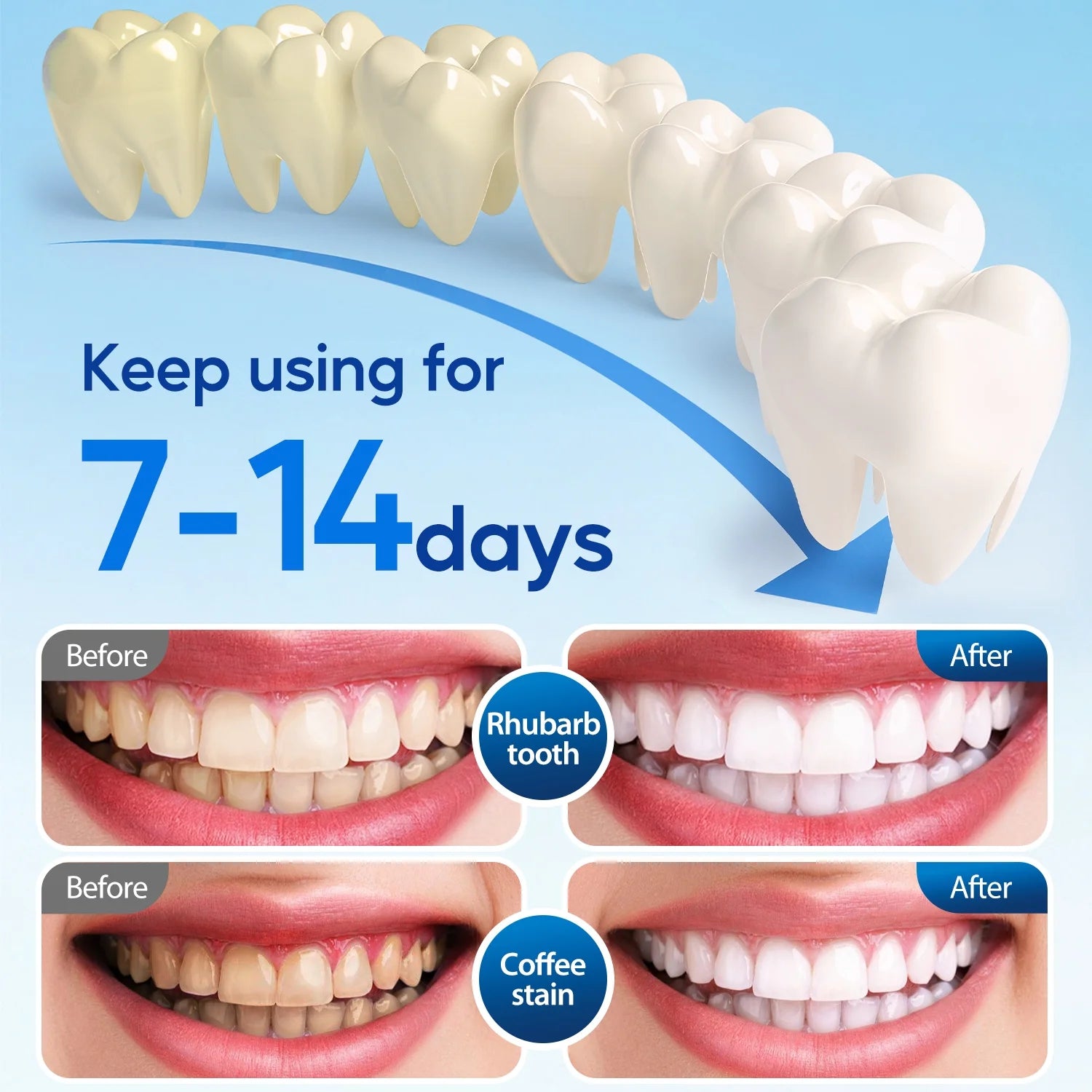 LED Teeth Whitening Strips Kit for Sensitive Teeth - 28 White Strips + 24 Blue Light Accelerator, 20Min Rapid White At-Home Dental Care for Smoking & Coffee Stains